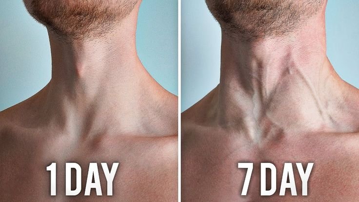 Comparison of a man's neck after 1 day and 7 days of bodyweight exercises, showing significant muscle growth and thickness